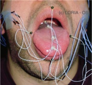 EMA sensors on the tongue